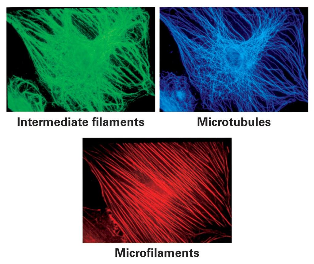 Três vistas de um fibroblasto filamentos