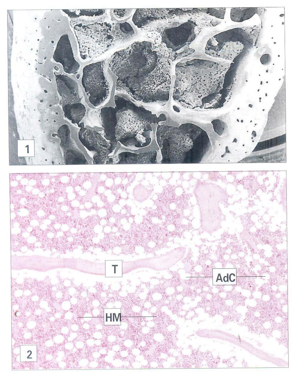 Immunapp Bioidea Laboratório de Imunofisiopatologia ICB USP 1) Nas cavidades dos ossos esponjosos, entre as trabéculas ósseas, ocorre a linfopoese das células B e a sua maturação ocorre radialmente