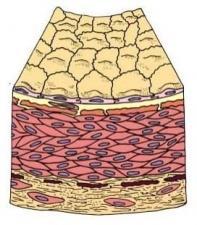 Parede vascular subendotelial lâmina elástica interna endotelial túnica íntima túnica média