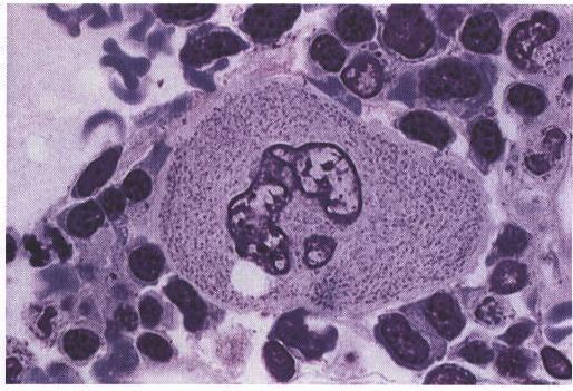 Núcleo Lobulado Nucléolos Não visíveis Citoplasma Granulações Megacariócito Fator de crescimento originado das plaquetas - angiogênese Fator de