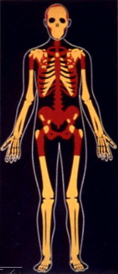 CARCINOMA da PRÓSTATA: METASTIZAÇÃO ÓSSEA Esqueleto mais frequentemente afectado: regiões de medula vermelha