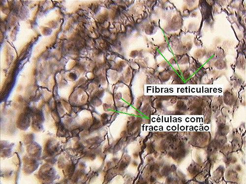 Medula óssea vermelha 1.