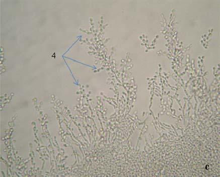 47 Figura 5.1 Micromorfologia dos isolados (em agar fubá) da mucosa oral de pacientes LPO (400X): a) C. albicans Presença de clamidóconídios terminais globosos (1), de parede espessa.