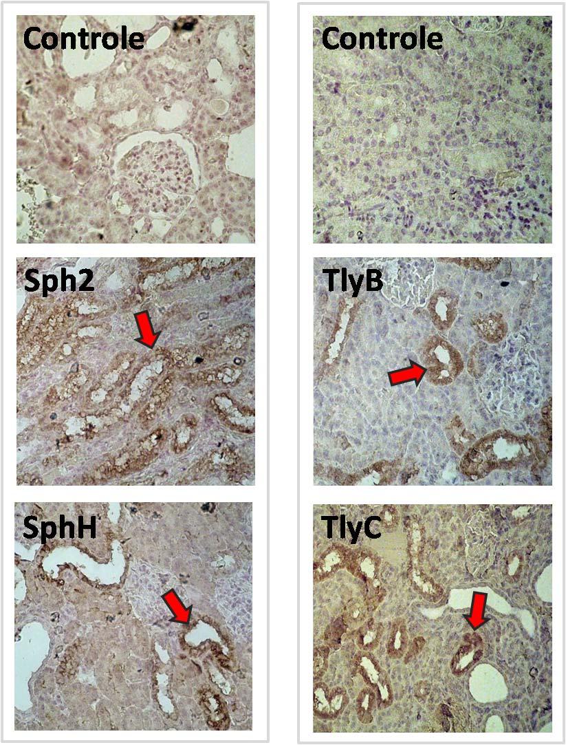 Figura 21: Expressão de algumas das proteínas estudadas durante a infecção por Leptospira em hamsters.