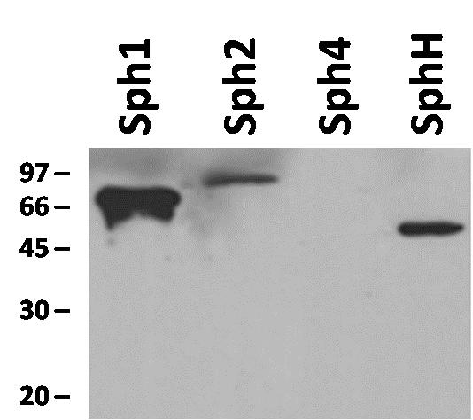 Figura 22: Antisoro contra rsph1 reconhece cruzadamente as esfingomeilinases recombiantes Sph2 e SphH, porém não reconhece Sph4 em um Western