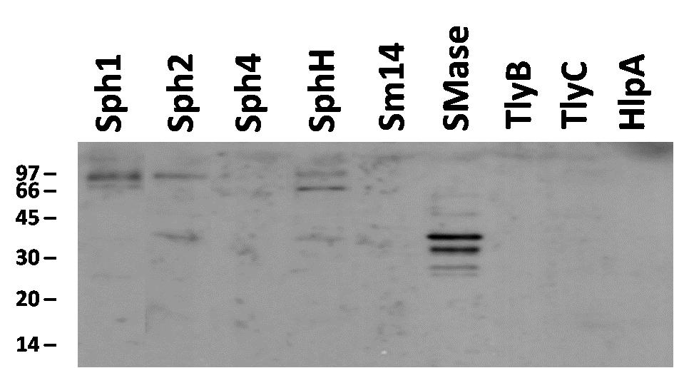 mansoni como controle negativo (Sm14) e a proteína majoritariamente expressa de leptospira LipL32 como controle positivo. Uma indicação de massa molecular (em KDa) é mostrada à esquerda.