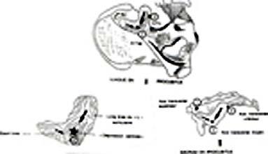 10 Superfícies Auriculares Os meios de união a) Ligamento sacroilíaco anterior que é confundido com a cápsula anterior e opõe-se à báscula anterior do promontório: limitando a nutação b) Ligamento