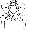 93 Figura : Deformação bicôncava e achatamento. Finas estrias verticais. A osteomalácia Coluna lombar de perfil Figura :Osteomalácia Deformação em cúpula dos platôs vertebrais.