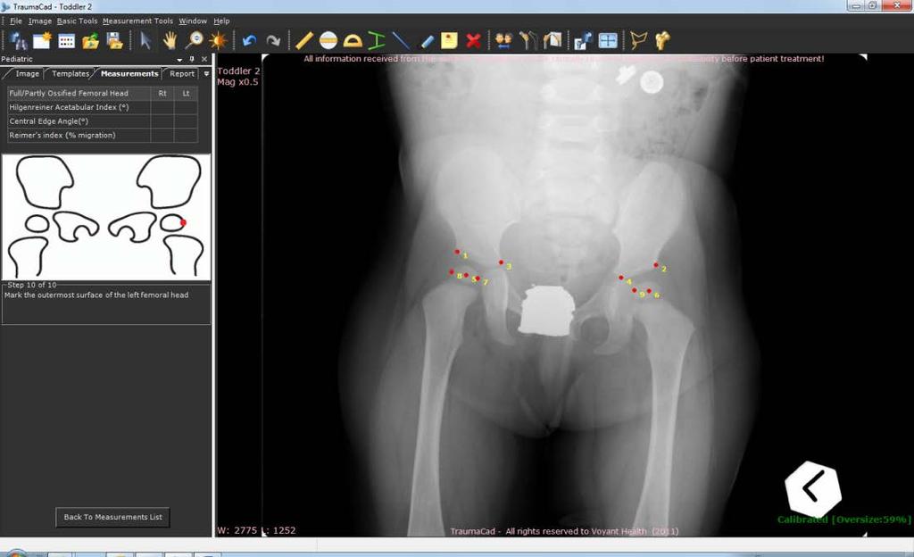 Medição da Anatomia 3 Siga os passos indicados no assistente e marque os pontos relevantes na imagem correspondentes a cada passo.