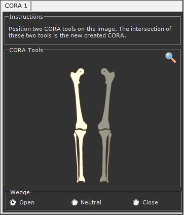 Guia do Usuário do TraumaCad CORA-Tools O Centro de Rotação da Angulação (CORA - Center of Rotation of Angulation) é a interseção do eixo do segmento proximal e do eixo do segmento distal.