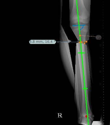 Medição da Anatomia 10 Verifique os valores que aparecem no aba Measurements. Os valores normais são apresentados a verde e os valores anormais a vermelho.