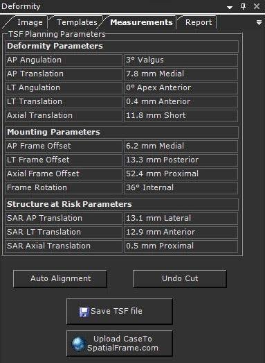 Medição da Anatomia A área Parâmetros de Planeamento TSF mostra todos os parâmetros calculados para a