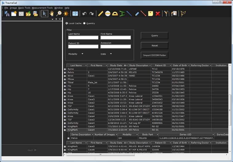 Manuseamento de Imagens Carregar Imagens de um PACS Encontrar o Paciente O TraumaCad fornece uma diversidade de opções para encontrar um paciente de interesse específico.