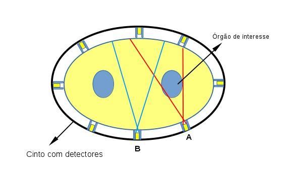 Figura 1 Esquema de uma das ideias discutidas na nossa conversa. O Detector A tem o rim no seu campo de visão, enquanto o Detector B não.