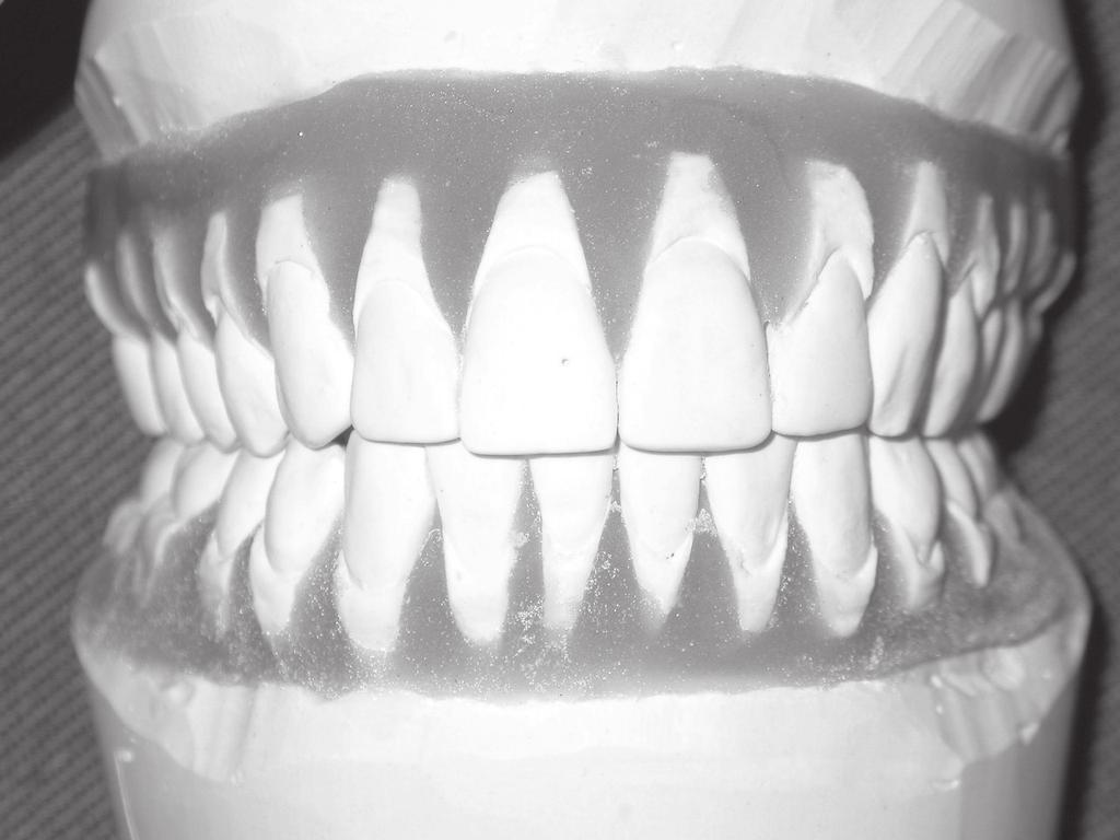 Figura 1 Imagem scaneda em detalhe da superfície dental Figura 2 Base do bráquete desenhada Figura 4