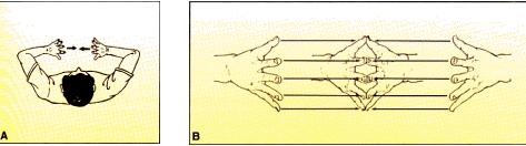 Esse exercício envolve as flexões palmar e dorsal de cada punho, alternadamente. Fonte: POI (5) Figura 6 A, B e C. Exercícios de alongamento das duas mãos para os punhos.