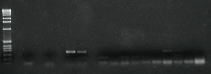 52 Figura 2 - Fotografia do gel da corrida de eletroforese das amostras de urina e fluido vaginal processadas para a realização da PCR (amplificação do gene LipL32) dos animais 1 a 6 do grupo de