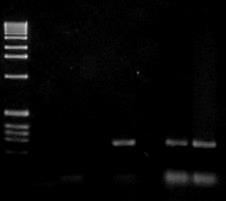 M CNe CNp CP 1 2 3 4 5 6 7 8 9 10 11 12 M- Marcador de peso molecular (100 bp); CNe- Controle Negativo da extração; CNp- Controle negativo da PCR; CP- Controle positivo; 1, 9 e 10: amostras positivas.