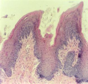 Figura 8.6 - Papilas filiformes. HE. 137x. Figura 8.7 - Papilas fungiformes. HE. 137x. Figura 8.9 - Corpúsculo gustativo.