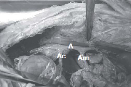 Suprimento arterial dos intestinos do coelho 103 raça Nova Zelândia, machos, provenientes do Setor de Cunicultura da FCAVJ-UNESP.