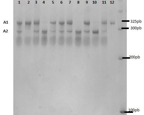 325pb obtido por PCR, após hidrólise com a enzima de restrição NsiI, revelou dois padrões de restrição. Figura 1.