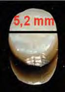 67 1,3 mm 3,5 mm 2,2 mm FIGURA 2 - Dimensões dos discos de esmalte/dentina obtidos a partir de incisivos bovinos.