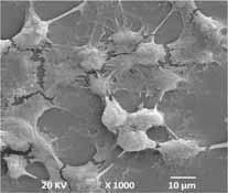 D: Detalhe das células de variada morfologia que permaneceram aderidas ao substrato  MEV, aumento