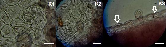 Seções Transversais do espécime do tipo floral rósea brevistila. K1 Detalhe de estômato tipo paracítico. Barra = aumento 1000x. K2 Grupo de estômatos. Barra = aumento 1000x. K3 Setas indicando a disposição dos estômatos na epiderme.