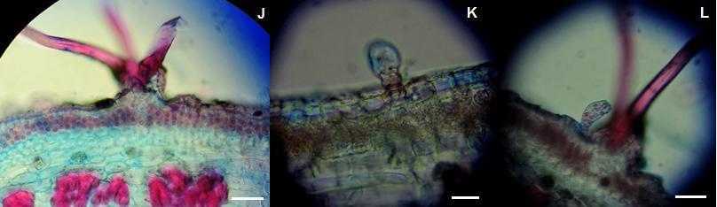 62 Quadro 3 - Secções transversais de caule dos três tipos florais evidenciando a epiderme corada com azul de alcian a 1% e safranina a 1% (9:1).