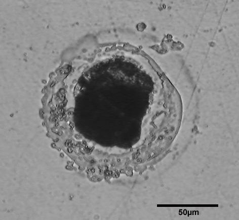 A Figura 21 apresenta a imagem do aço da amostra GA após análise em microcélula.