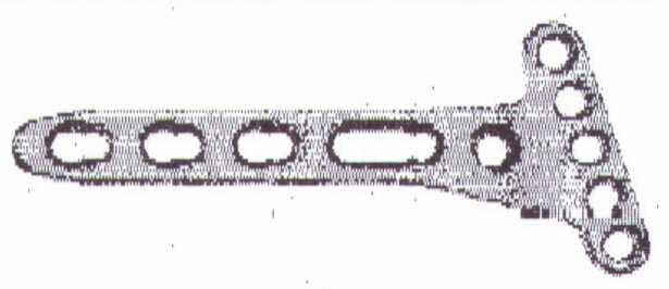 169-55 PLACA PBA PONTE COM ANTECURVATO 4.5mm DE 10 FUROS E 179mm 169-56 PLACA PBA PONTE COM ANTECURVATO 4.5mm DE 10 FUROS E 189mm 169-57 PLACA PBA PONTE COM ANTECURVATO 4.