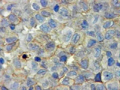 Histiocitose de células de Langerhans Anticorpo