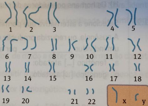 4. A espermatogénese, ou produção de espermatozoides, ocorre ao nível: a) dos túbulos seminíferos b) dos espermatídios c) das glândulas de Cowper d) dos epididímios 5.