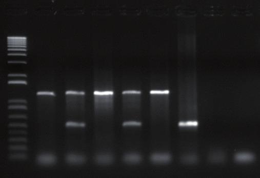 16 Infectividade da Cigarrinha Dalbulus maidis com Fitoplasma e Espiroplasma em A M 1 2 3 4 F E S B 1016 pb 1200 pb 500 pb 500 pb 100 pb B C M 1 2 B M 1 2 B 574 pb 560 pb