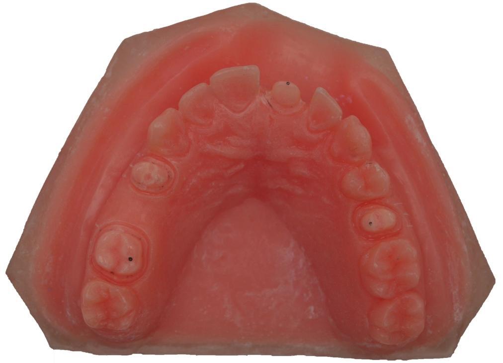 36 Figura 1 - Modelo mestre maxilar à base de polimetilmetacrilato (PMMA), com preparos para coroa total nos dentes 14,