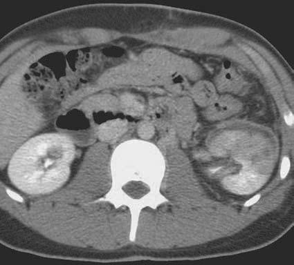 1 Trauma/Lesão Renal Fig. 1.