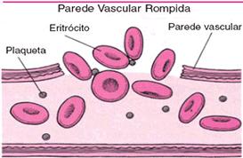 temporária. As plaquetas As plaquetas são fragmentos celulares bem menores que as células sanguíneas, ou seja, menores que as hemácias e os leucócitos.
