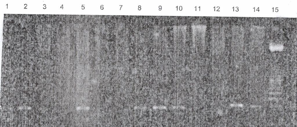 52 Resultado dos produtos da primeira etapa da FOR utilizando os iniciadores T1U2 e T1D amplificaram o DNA do gênero Mycobacterium com fragmentos de 310pb nas amostras de tecidos fixados (Figura 2).