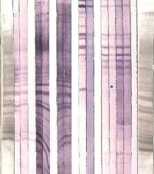 Western Blotting Procedimento : a