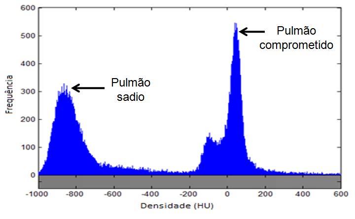 20 Figura 9 - Histograma do corte tomográfico após segmentação manual, destacando o pico referente a pulmão sadio e comprometido.