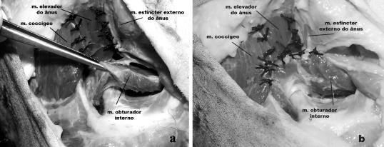 Hérnia perineal em cães. 1225 Figura 3 Demonstração da reconstrução do diafragma pélvico de cão pela transposição do músculo obturador interno sem secção do tendão.