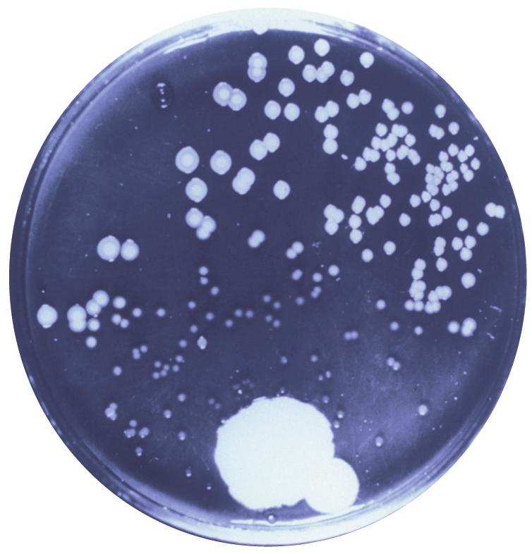 CAPÍTULO 1 O mundo microbiano e você 11 Colônia bacteriana normal Área de inibição do crescimento bacteriano Colônia de Penicillium Figura 1.5 A descoberta da penicilina.