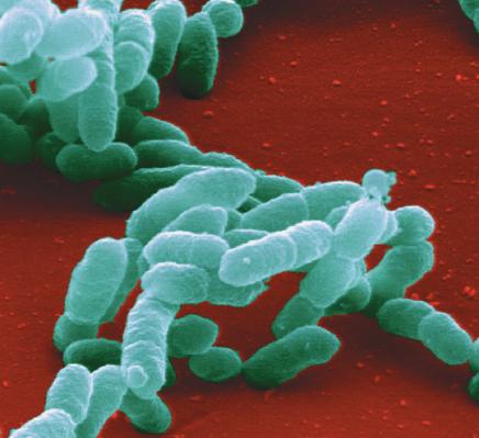 CAPÍTULO 1 O mundo microbiano e você 5 Bactérias Esporângios Partícula de alimento Célula CD4 + T HIVs Pseudópodes (a) SEM (b) SEM (c) SEM (d) 3 m 50 m 50 m Figura 1.1 Tipos de microrganismos.