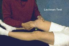 Teste de Lachman Teste do Ligamento Cruzado Anterior Colocar o joelho em leve flexão com um ângulo de 20 a 30º.