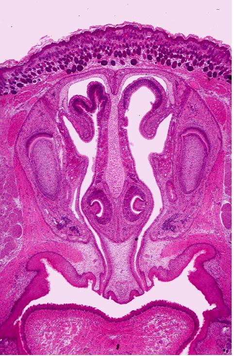 Dividida em 3 regiões histologicamente diferentes: região vestibular, respiratória e olfatória.