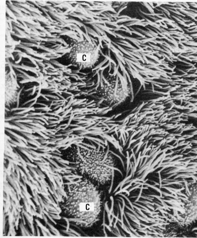 Tipos de células: cilíndrica ciliada possui batimento ciliar que provoca movimento do muco em direção à faringe caliciforme