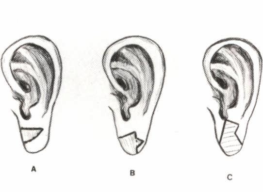 Pavilhão auricular 1,37 pequeno tamanho e discreta função, principalmente no lóbulo onde as fibras musculares são praticamente inexistentes.