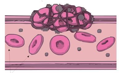 Plaquetas - Assim como as hemácias, consistem em células incompletas, pois não apresentam núcleo celular.