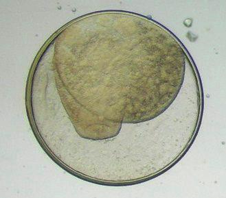 Pesquisa de trematódeos digenéticos em Heleobia spp. (Mollusca: Hydrobiidae) em área de ocorrência da ehrlichiose monocítica equina, no Rio Grande do Sul, Brasil Anisoptera (320) e Zigoptera (37).