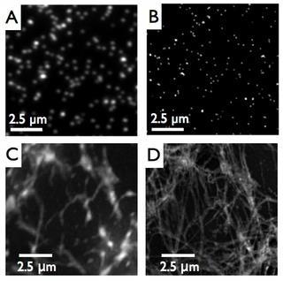 Iluminação Estruturada de Microscopia (SIM) Na SIM a iluminação é chamada de Modulação de Luz Espacial (SLM).